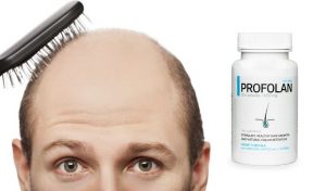 Como Profolan for hair - funciona. ¿Tiene efectos secundarios?